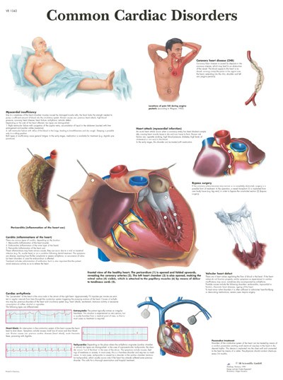 All Products - Common Cardiac Disorders