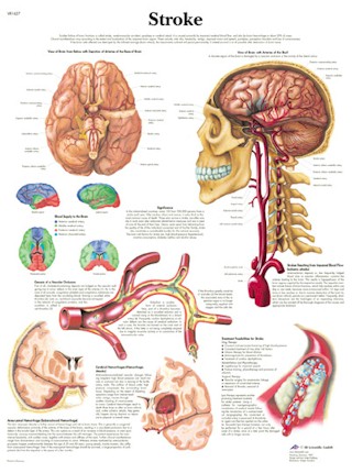 All Products - Wandkaart: Stroke