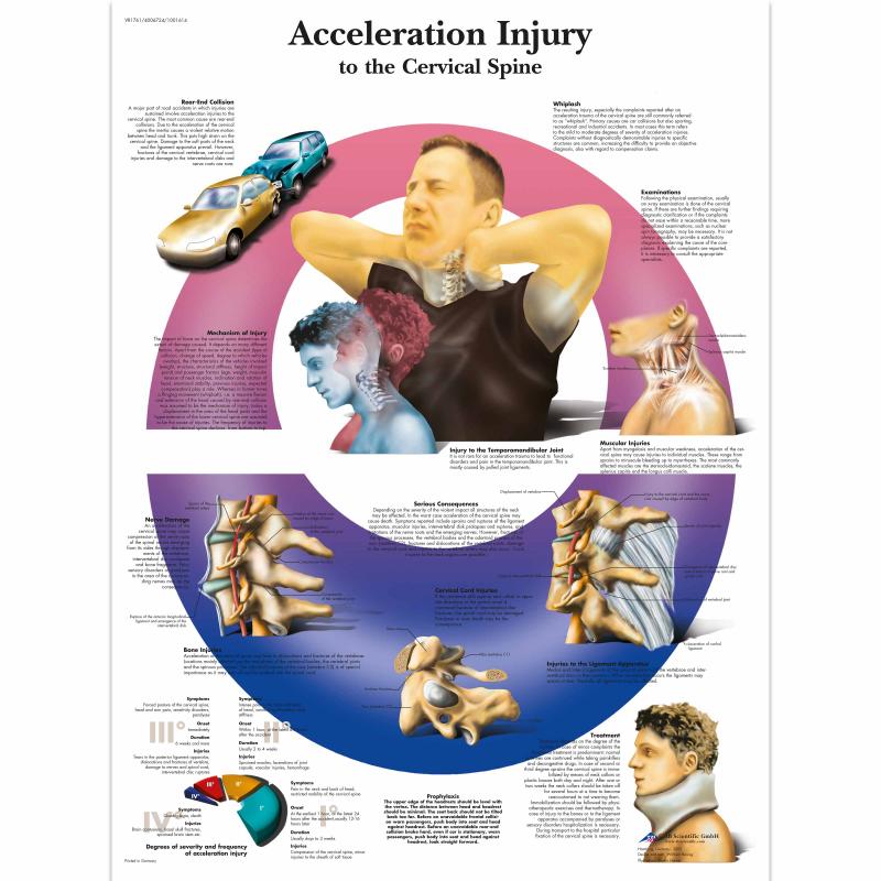 Wandkaart: Acceleration injury to the cervical spine